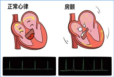 图片1_副本.png