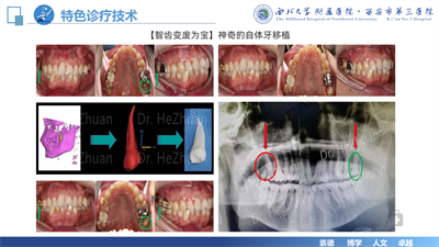 口腔科宣传展示(2)_13.png